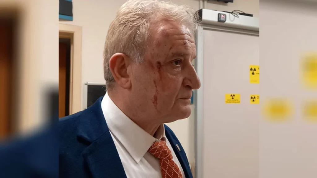 Eskişehir Basınını Hedef Alan Alçak Pusu! Hakkı Sağlam’a “Kaza Süsü” Verip Saldırdılar: “Sizi Kim Gönderdi?