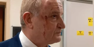 Eskişehir Basınını Hedef Alan Alçak Pusu! Hakkı Sağlam’a “Kaza Süsü” Verip Saldırdılar: “Sizi Kim Gönderdi?