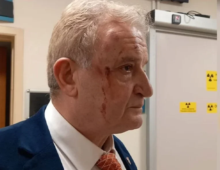 Eskişehir Basınını Hedef Alan Alçak Pusu! Hakkı Sağlam’a “Kaza Süsü” Verip Saldırdılar: “Sizi Kim Gönderdi?